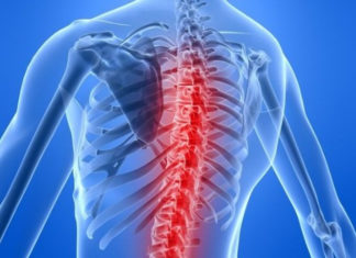 Інволютивний остеопороз. Компресійні, неускладнені переломи тіл Th11, Th12 хребців. Полісегментарний спондилоартроз. Артроз крижово-клубових суглобів.Клінічний приклад