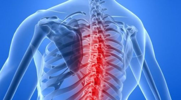 Інволютивний остеопороз. Компресійні, неускладнені переломи тіл Th11, Th12 хребців. Полісегментарний спондилоартроз. Артроз крижово-клубових суглобів.Клінічний приклад