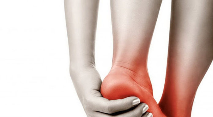 Сірінгомієлія на рівні ThIV – ThV. Паралітична п’ятково-вальгусна деформація обох стоп. Значне порушення функції ходи та опори. Клінічний випадок