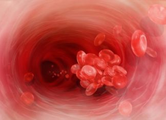 Венозний тромбоемболізм: як оцінити ризики та вчасно розпочати профілактику?