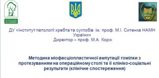 Методика міофасціопластичної ампутації гомілки з протезуванням на операційному столі та її клініко-соціальні результати (клінічне спостереження)