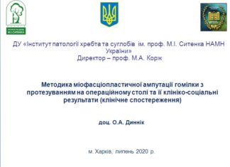 Методика міофасціопластичної ампутації гомілки з протезуванням на операційному столі та її клініко-соціальні результати (клінічне спостереження)