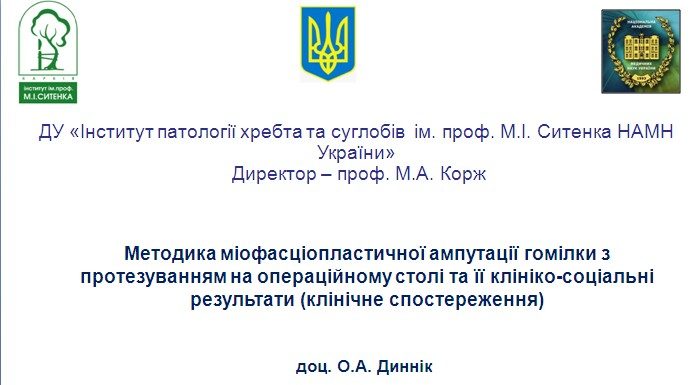 Методика міофасціопластичної ампутації гомілки з протезуванням на операційному столі та її клініко-соціальні результати (клінічне спостереження)