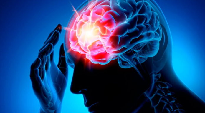 Мозкові інсульти. Що потрібно знати