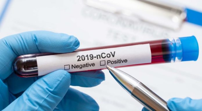 Інформація щодо COVID-19 станом на 05.11.2020 р.