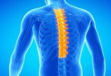 Правобічний ідіопатичний грудний сколіоз IV ступеня. Клінічний випадок