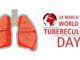 До Всесвітнього дня боротьби з туберкульозом