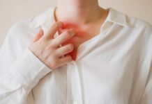 УРАЖЕННЯ ШКІРИ, АСОЦІЙОВАНІ З ГОСТРОЮ РЕСПІРАТОРНОЮ ХВОРОБОЮ COVID-19