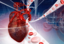 Гіпертонія та гострий інфаркт міокарду