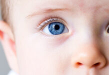 Іридоціліарні пухлини дитячого віку