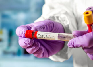 Кількість госпіталізованих з COVID-19 в установах НАМН України станом на 20.05.2021 р.