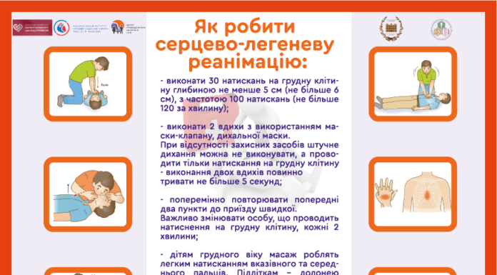 Як робити серцево-легеневу реанімацію