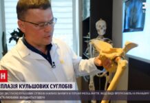 Чому важливо робити УЗД кульшових суглобів у перші 6 тижнів життя