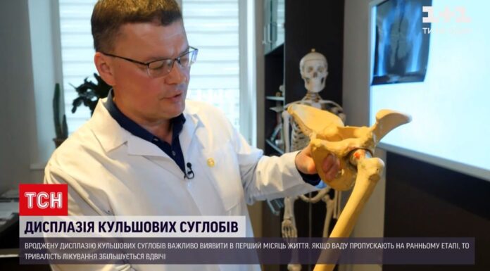 Чому важливо робити УЗД кульшових суглобів у перші 6 тижнів життя