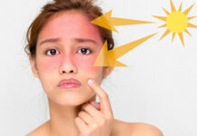 Сонячне світло та його шкідливий вплив на шкіру