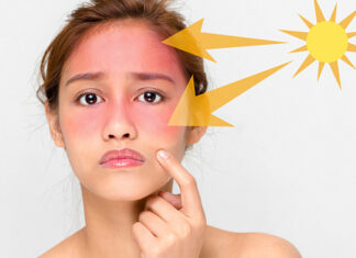 Сонячне світло та його шкідливий вплив на шкіру