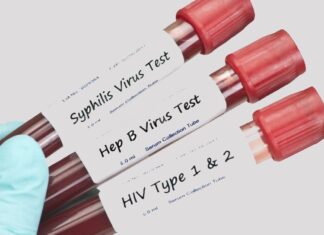 Інфекції, які передаються статевим шляхом – глобальна проблема у світі