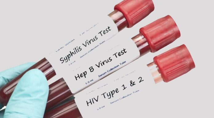 Інфекції, які передаються статевим шляхом – глобальна проблема у світі