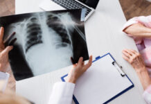 Легені при важкому перебігу Covid-19 – це суцільний згусток крові – академік Фещенко