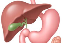 Органозберігаючі операції в лікуванні жовчокам’яної хвороби (лапароскопічна холецистолітотомія)