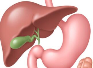 Органозберігаючі операції в лікуванні жовчокам’яної хвороби (лапароскопічна холецистолітотомія)