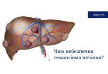 Чим небезпечна гемангіома печінки?