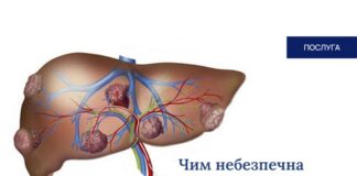 Чим небезпечна гемангіома печінки?