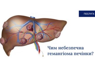 Чим небезпечна гемангіома печінки?