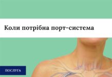 Коли потрібна порт-система