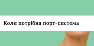 Коли потрібна порт-система