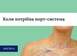 Коли потрібна порт-система