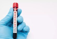 МАВПЯЧА ВІСПА: НОВІ АСПЕКТИ НИНІШНЬОГО СПАЛАХУ. MONKEYPOX: NEW ASPECTS OF THE ONGOING OUTBREAK