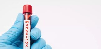 МАВПЯЧА ВІСПА: НОВІ АСПЕКТИ НИНІШНЬОГО СПАЛАХУ. MONKEYPOX: NEW ASPECTS OF THE ONGOING OUTBREAK