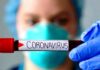РОЗВИТОК ЕПІДЕМІЧНОГО ПРОЦЕСУ COVID-19 В УКРАЇНІ. DEVELOPMENT OF THE EPIDEMIC PROCESS OF COVID-19 IN UKRAINE
