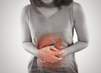 Манодебітометрія в діагностиці позапечінкового холестазу при ускладненному холелітіазі. Методичні рекомендації