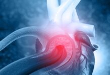 Синдром Марфана – не вирок