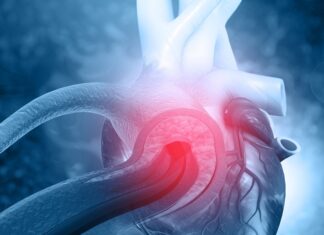 Синдром Марфана – не вирок