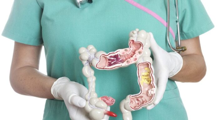 Cучасні підходи до лікування синдрому подразненого кишечнику. Методичні рекомендації