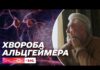 Що потрібно знати кожному про хворобу Альцгеймера і чому важлива рання діагностика