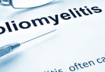 СЬОГОДНІШНІ ПРОБЛЕМИ ПОЛІОМІЄЛІТУ. СИТУАЦІЯ У СВІТІ ТА УКРАЇНІ. ШЛЯХИ ВИРІШЕННЯ