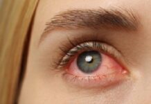 ЩО ТАКЕ СИНДРОМ «ЧЕРВОНОГО ОКА»?