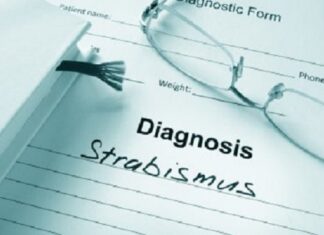 ПЕРЕДОПЕРАЦІЙНІ ПОКАЗНИКИ СТАНУ ЗОРОВИХ ФУНКЦІЙ, ЩО ВПЛИВАЮТЬ НА РЕЗУЛЬТАТ ХІРУРГІЧНОГО ЛІКУВАННЯ РОЗБІЖНОЇ КОСООКОСТІ