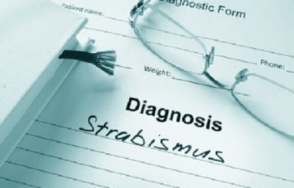 ПЕРЕДОПЕРАЦІЙНІ ПОКАЗНИКИ СТАНУ ЗОРОВИХ ФУНКЦІЙ, ЩО ВПЛИВАЮТЬ НА РЕЗУЛЬТАТ ХІРУРГІЧНОГО ЛІКУВАННЯ РОЗБІЖНОЇ КОСООКОСТІ