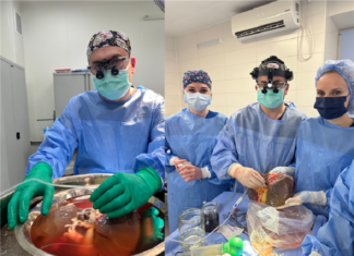 Трансплантації тривають