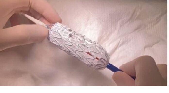 Навіть попри війну, до нас їдуть оперуватись іноземці