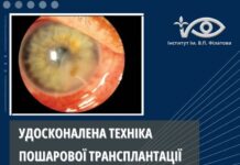 УДОСКОНАЛЕНА ТЕХНІКА ПОШАРОВОЇ ТРАНСПЛАНТАЦІЇ АМНІОТИЧНОЇ МЕМБРАНИ