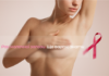 Рак молочної залози. Що варто знати