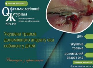Укушена травма допоміжного апарату ока собакою у дітей