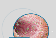 Хвороба Крона