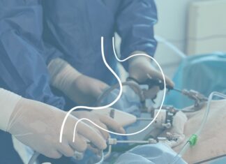 Баріатрична хірургія